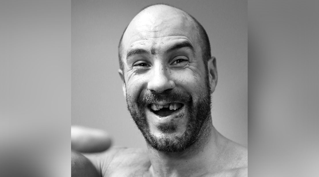 Cesaro Cheerfully Shows Off Gruesome Broken Teeth in the