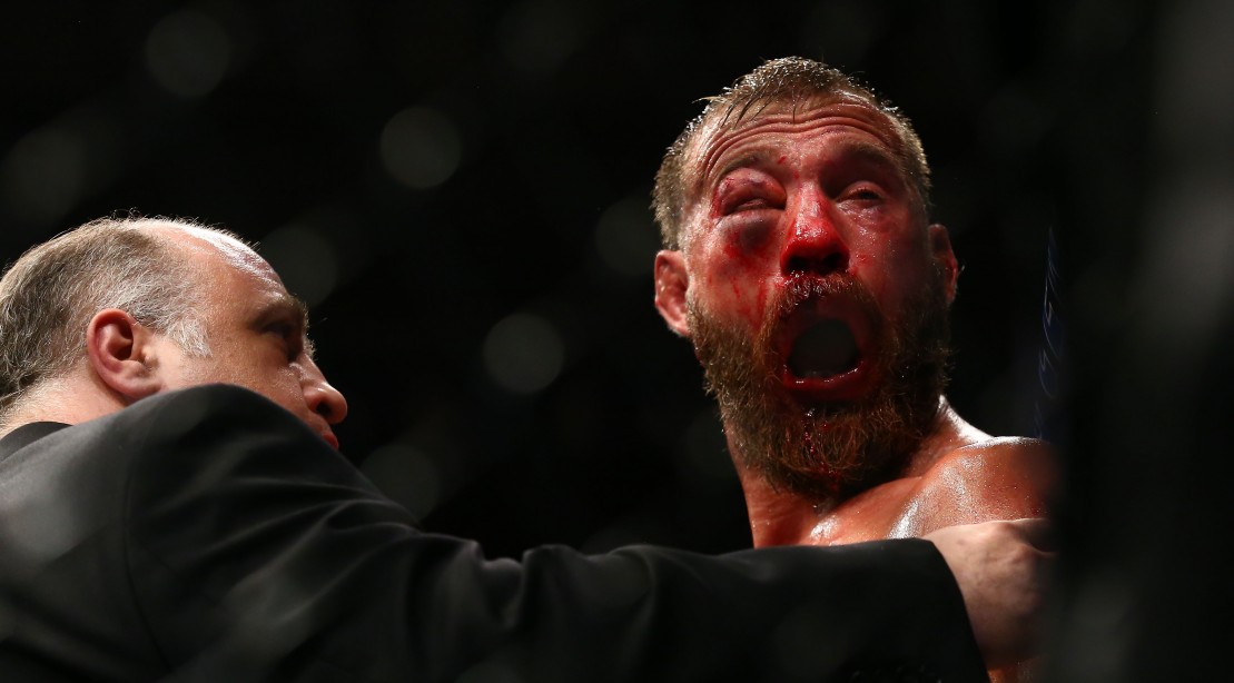 Donald Cerrone reacts after doctors call off his lightweight bout against Tony Ferguson during the UFC 238 event at United Center on June 8, 2019 in Chicago, Illinois.