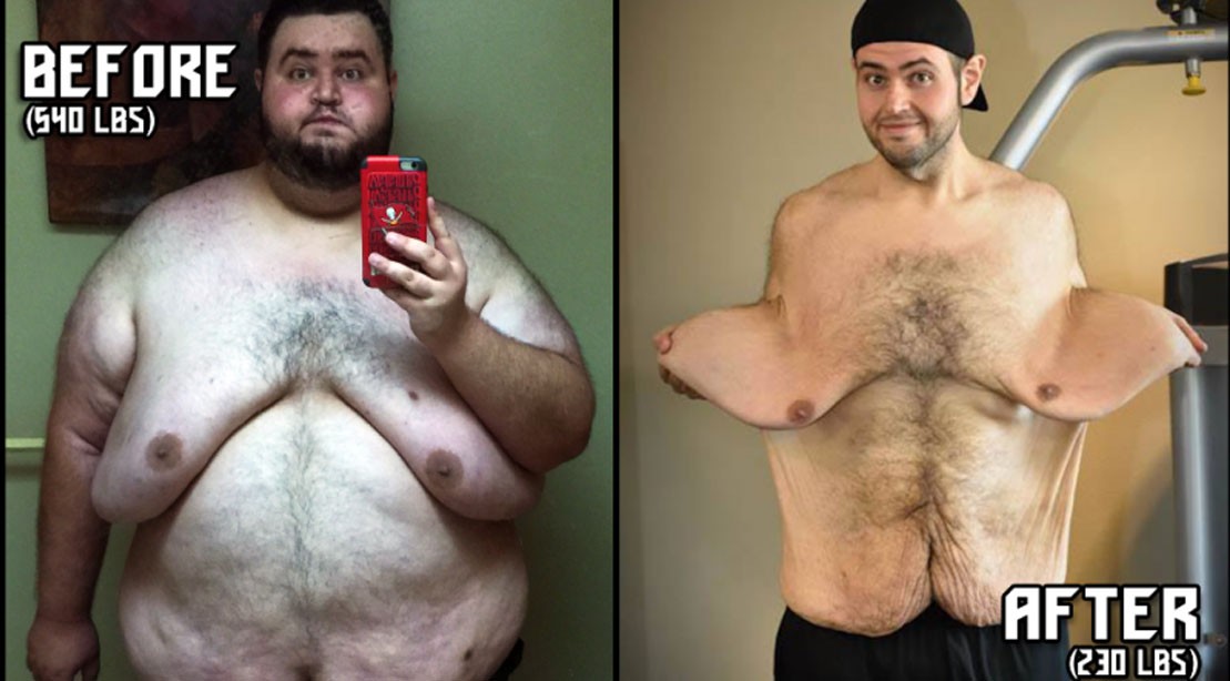 John Allaire Weight Loss John Allaire Loses Over 300 Pounds in Incredible Transformation