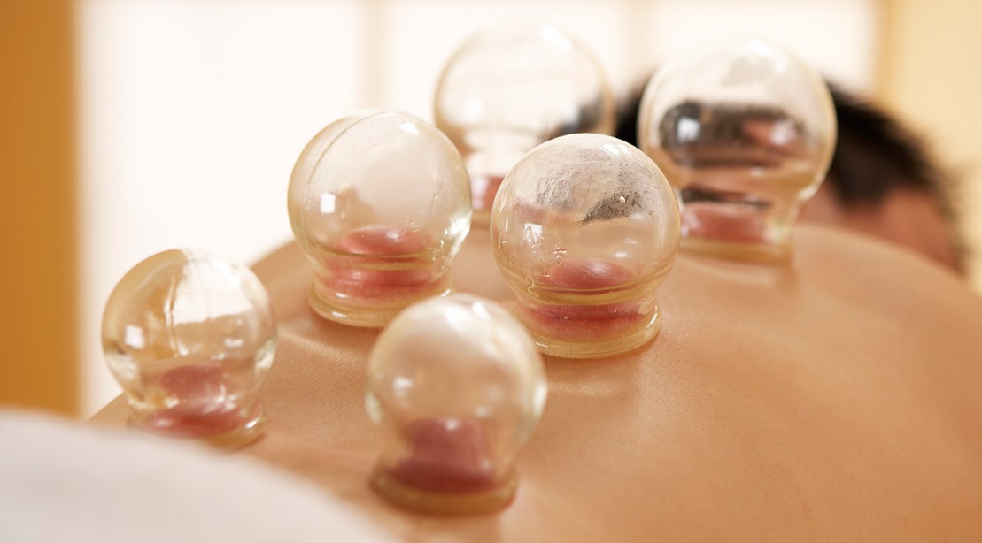 6 Things to Know About Cupping Therapy Muscle & Fitness